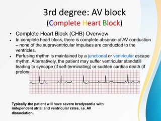 ECG.pptx