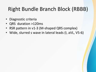 Rsr Rbbbb ECG.pptx