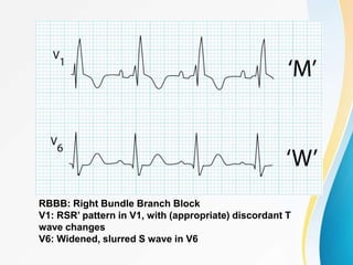 ECG.pptx