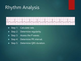 Rhythym Calculation Using 1500 Method ECG | PPT