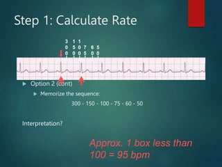ECG | PPT