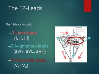 ECG | PPT