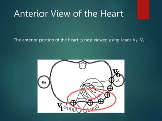 Anterior View of the Heart
The anterior portion of the heart is best viewed using leads V1- V4.
 