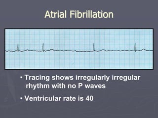 ecg.pptx