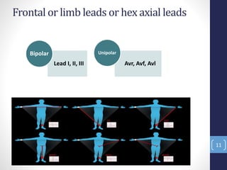 Frontal or limb leads or hex axial leads
11
Lead I, II, III
Bipolar
Avr, Avf, Avl
Unipolar
 