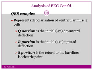 Downward Deflection ECG.ppt