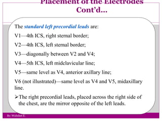 ECG.ppt