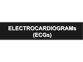 ELECTROCARDIOGRAMs
(ECGs)
 