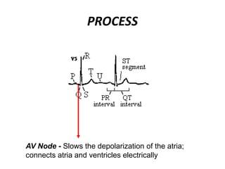 PROCESS
AV Node - Slows the depolarization of the atria;
connects atria and ventricles electrically
 