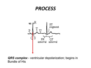 PROCESS
QRS complex - ventricular depolarization; begins in
Bundle of His
 