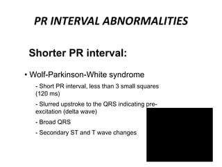 PR INTERVAL ABNORMALITIES
Shorter PR interval:
• Wolf-Parkinson-White syndrome
- Short PR interval, less than 3 small squares
(120 ms)
- Slurred upstroke to the QRS indicating pre-
excitation (delta wave)
- Broad QRS
- Secondary ST and T wave changes
 