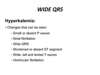 WIDE QRS
- Small or absent P waves
- Atrial fibrillation
- Wide QRS
- Shortened or absent ST segment
- Wide, tall and tented T waves
- Ventricular fibrillation
Hyperkalemia:
• Changes that can be seen:
 