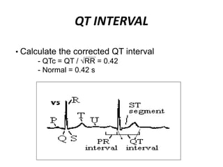 QT INTERVAL
• Calculate the corrected QT interval
- QTc = QT / RR = 0.42
- Normal = 0.42 s
 