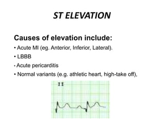 ST ELEVATION
Causes of elevation include:
• Acute MI (eg. Anterior, Inferior, Lateral).
• LBBB
• Acute pericarditis
• Normal variants (e.g. athletic heart, high-take off),
 