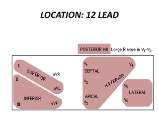 LOCATION: 12 LEAD
 