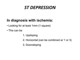 ST DEPRESSION
In diagnosis with ischemia:
• Looking for at least 1mm (1 square)
• This can be
1. Upsloping
2. Horizontal (can be combined w/ 1 or 3)
3. Downsloping
 