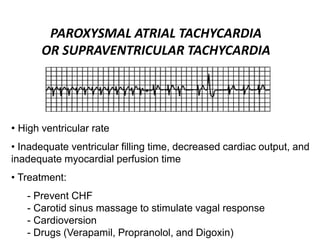 PAROXYSMAL ATRIAL TACHYCARDIA
OR SUPRAVENTRICULAR TACHYCARDIA
• High ventricular rate
• Inadequate ventricular filling time, decreased cardiac output, and
inadequate myocardial perfusion time
• Treatment:
- Prevent CHF
- Carotid sinus massage to stimulate vagal response
- Cardioversion
- Drugs (Verapamil, Propranolol, and Digoxin)
 
