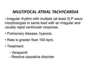 MULTIFOCAL ATRIAL TACHYCARDIA
• Irregular rhythm with multiple (at least 3) P wave
morphologies in same lead with an irregular and
usually rapid ventricular response.
• Pulmonary disease, hypoxia.
• Rate is greater than 100 bpm.
• Treatment:
- Verapamil
- Resolve causative disorder
 