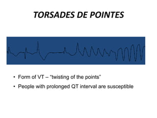 TORSADES DE POINTES
• Form of VT – “twisting of the points”
• People with prolonged QT interval are susceptible
 