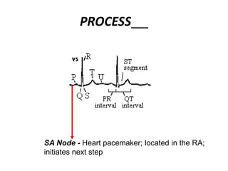 PROCESS
SA Node - Heart pacemaker; located in the RA;
initiates next step
 