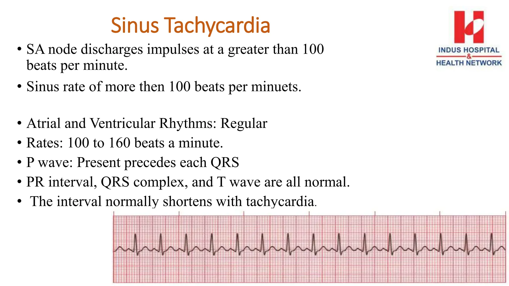 Sinus Tachycardia
• SA node discharges impulses at a greater than 100
beats per minute.
• Sinus rate of more then 100 beats per minuets.
• Atrial and Ventricular Rhythms: Regular
• Rates: 100 to 160 beats a minute.
• P wave: Present precedes each QRS
• PR interval, QRS complex, and T wave are all normal.
• The interval normally shortens with tachycardia.
 