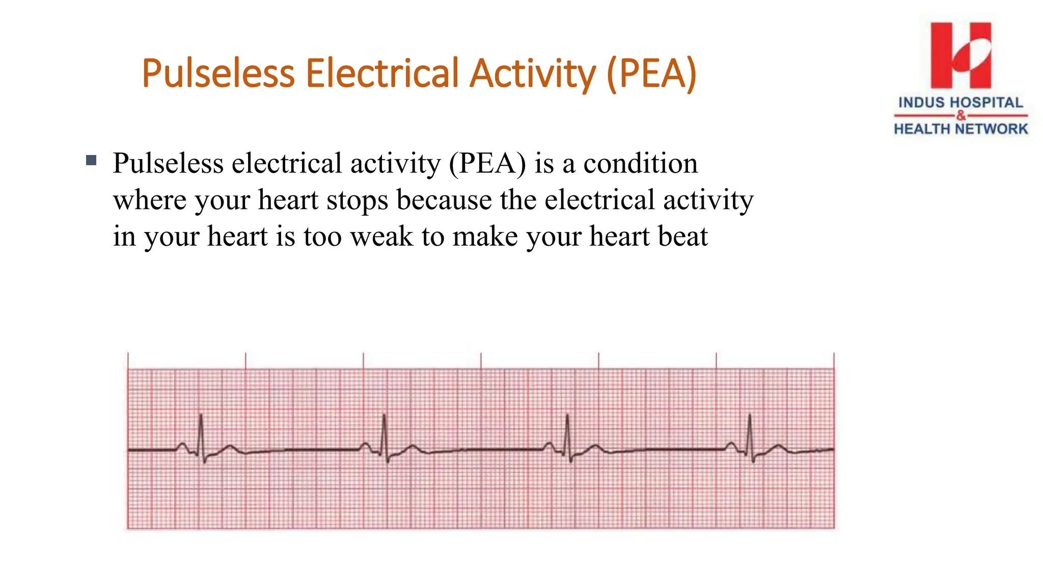 Pulseless Electrical Activity (PEA)
 Pulseless electrical activity (PEA) is a condition
where your heart stops because the electrical activity
in your heart is too weak to make your heart beat
 