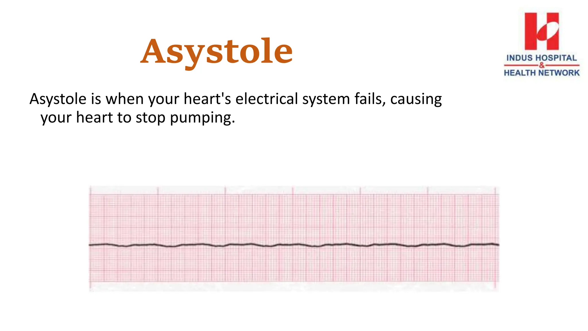 Asystole
Asystole is when your heart's electrical system fails, causing
your heart to stop pumping.
 