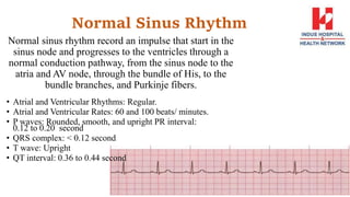 Basics of ECG.pptx