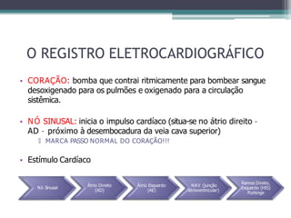 O REGISTRO ELETROCARDIOGRÁFICO
• CORAÇÃO: bomba que contrai ritmicamente para bombear sangue
desoxigenado para os pulmões e oxigenado para a circulação
sistêmica.
• NÓ SINUSAL: inicia o impulso cardíaco (situa-se no átrio direito –
AD – próximo à desembocadura da veia cava superior)
🞄 MARCA PASSO NORMAL DO CORAÇÃO!!!
• Estímulo Cardíaco
Nó Sinusal
Átrio Direito
(AD)
Átrio Esquerdo
(AE)
NAV (junção
atrioventricular)
Ramos Direito,
Esquerdo (HIS)
Purkinge
 