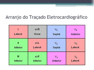 Arranjo do Traçado Eletrocardiográfico
 