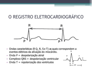 O REGISTRO ELETROCARDIOGRÁFICO
• Ondas características (P
, Q, R, S e T) as quais correspondem a
eventos elétricos da ativação do miocárdio.
• Onda P = despolarização atrial
• Complexo QRS = despolarização ventricular
• Onda T = repolarização dos ventrículos
 