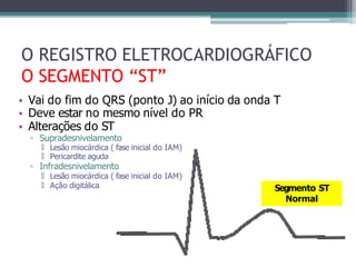 • Vai do fim do QRS (ponto J) ao início da onda T
• Deve estar no mesmo nível do PR
• Alterações do ST
▫ Supradesnivelamento
🞄 Lesão miocárdica ( fase inicial do IAM)
🞄 Pericardite aguda
▫ Infradesnivelamento
🞄 Lesão miocárdica ( fase inicial do IAM)
🞄 Ação digitálica
O REGISTRO ELETROCARDIOGRÁFICO
O SEGMENTO “ST”
Segmento ST
Normal
 