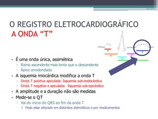 O REGISTRO ELETROCARDIOGRÁFICO
A ONDA “T”
• É uma onda única, assimétrica
▫ Ramo ascendente mais lento que o descendente
▫ Ápice arredondado
• A isquemia miocárdica modifica a onda T
▫ Onda T positiva apiculada: Isquemia sub-endocárdica
▫ Onda T negativa e apiculada: Isquemia sub-epicárdica
• A amplitude e a duração não são medidas
• Mede-se o QT
▫ Vai do início do QRS ao fim da onda T
🞄 Pode estar alterado em distúrbios eletrolíticos e por medicamentos
 