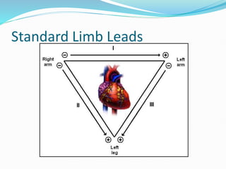 Standard Limb Leads
 