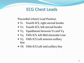 16
Precardial (chest) Lead Position
 V1 Fourth ICS, right sternal border
 V2 Fourth ICS, left sternal border
 V3 Equidistant between V2 and V4
 V4 Fifth ICS, left Mid clavicular Line
 V5 Fifth ICS Left anterior axillary
line
 V6 Fifth ICS Left mid axillary line
ECG Chest Leads
 