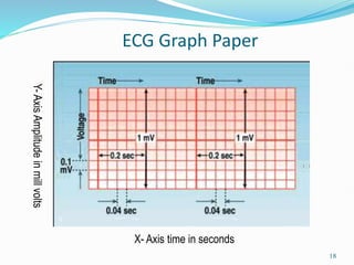 18
ECG Graph Paper
X- Axis time in seconds
Y-
Axis
Amplitude
in
mill
volts
 