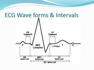 ECG Wave forms & Intervals
 