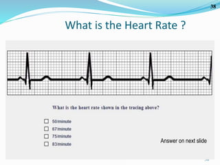 38
38
What is the Heart Rate ?
Answer on next slide
 