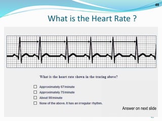 40
40
What is the Heart Rate ?
Answer on next slide
 