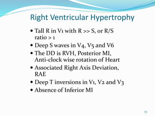 53
 Tall R in V1 with R >> S, or R/S
ratio > 1
 Deep S waves in V4, V5 and V6
 The DD is RVH, Posterior MI,
Anti-clock wise rotation of Heart
 Associated Right Axis Deviation,
RAE
 Deep T inversions in V1, V2 and V3
 Absence of Inferior MI
Right Ventricular Hypertrophy
 