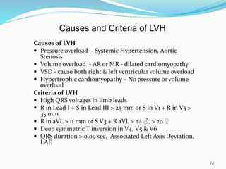 61
Causes of LVH
 Pressure overload - Systemic Hypertension, Aortic
Stenosis
 Volume overload - AR or MR - dilated cardiomyopathy
 VSD - cause both right & left ventricular volume overload
 Hypertrophic cardiomyopathy – No pressure or volume
overload
Criteria of LVH
 High QRS voltages in limb leads
 R in Lead I + S in Lead III > 25 mm or S in V1 + R in V5 >
35 mm
 R in aVL > 11 mm or S V3 + R aVL > 24 ♂, > 20 ♀
 Deep symmetric T inversion in V4, V5 & V6
 QRS duration > 0.09 sec, Associated Left Axis Deviation,
LAE
Causes and Criteria of LVH
 