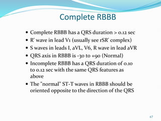 67
Complete RBBB
 Complete RBBB has a QRS duration > 0.12 sec
 R' wave in lead V1 (usually see rSR' complex)
 S waves in leads I, aVL, V6, R wave in lead aVR
 QRS axis in RBBB is -30 to +90 (Normal)
 Incomplete RBBB has a QRS duration of 0.10
to 0.12 sec with the same QRS features as
above
 The "normal" ST-T waves in RBBB should be
oriented opposite to the direction of the QRS
 