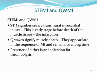 78
STEMI and QWMI
STEMI and QWMI
 ST ↑ signifies severe transmural myocardial
injury – This is early stage before death of the
muscle tissue – the infarction
 Q waves signify muscle death – They appear late
in the sequence of MI and remain for a long time
 Presence of either is an indication for
thrombolysis
 
