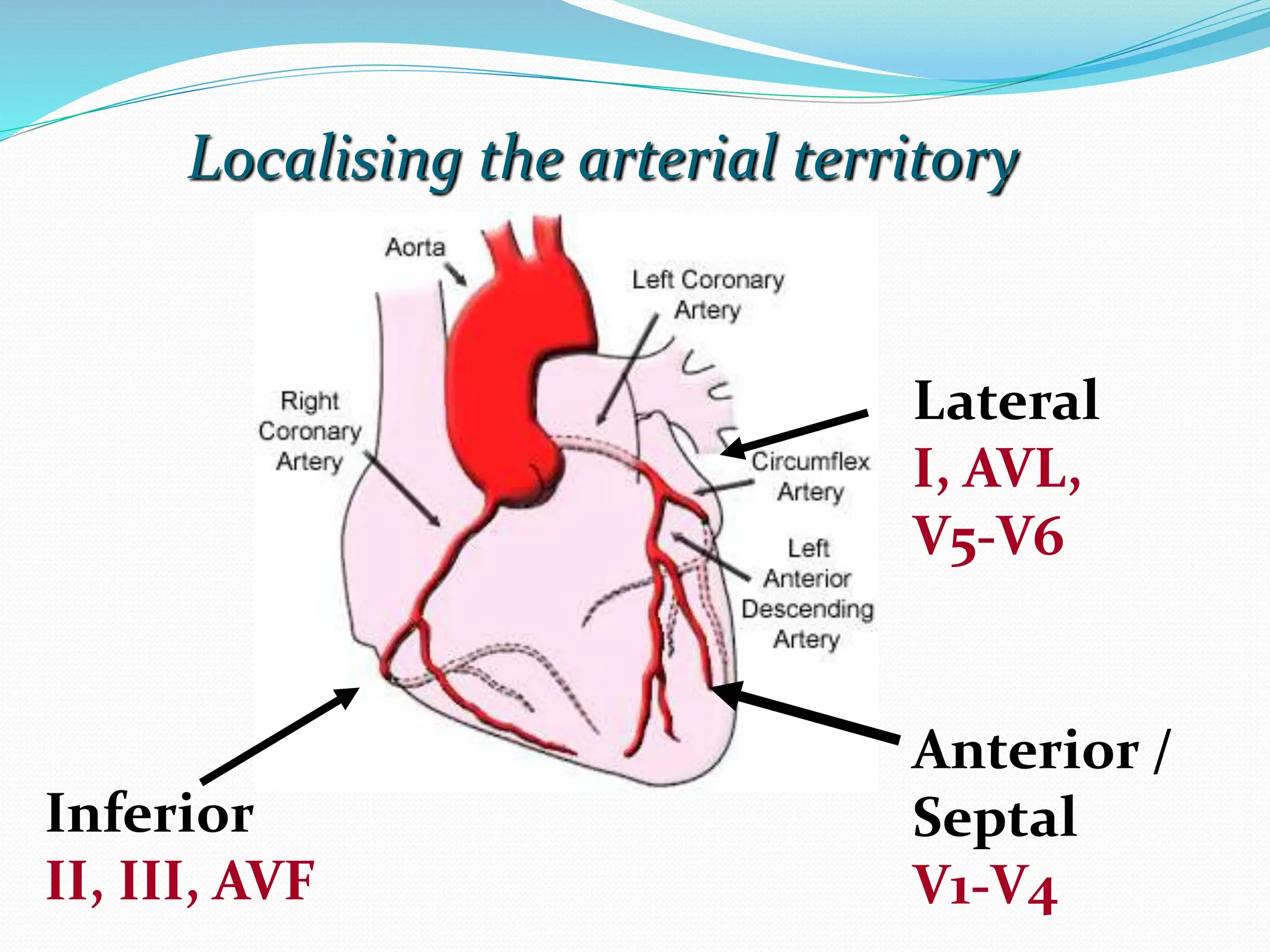 Localising the arterial territory
Inferior
II, III, AVF
Lateral
I, AVL,
V5-V6
Anterior /
Septal
V1-V4
 