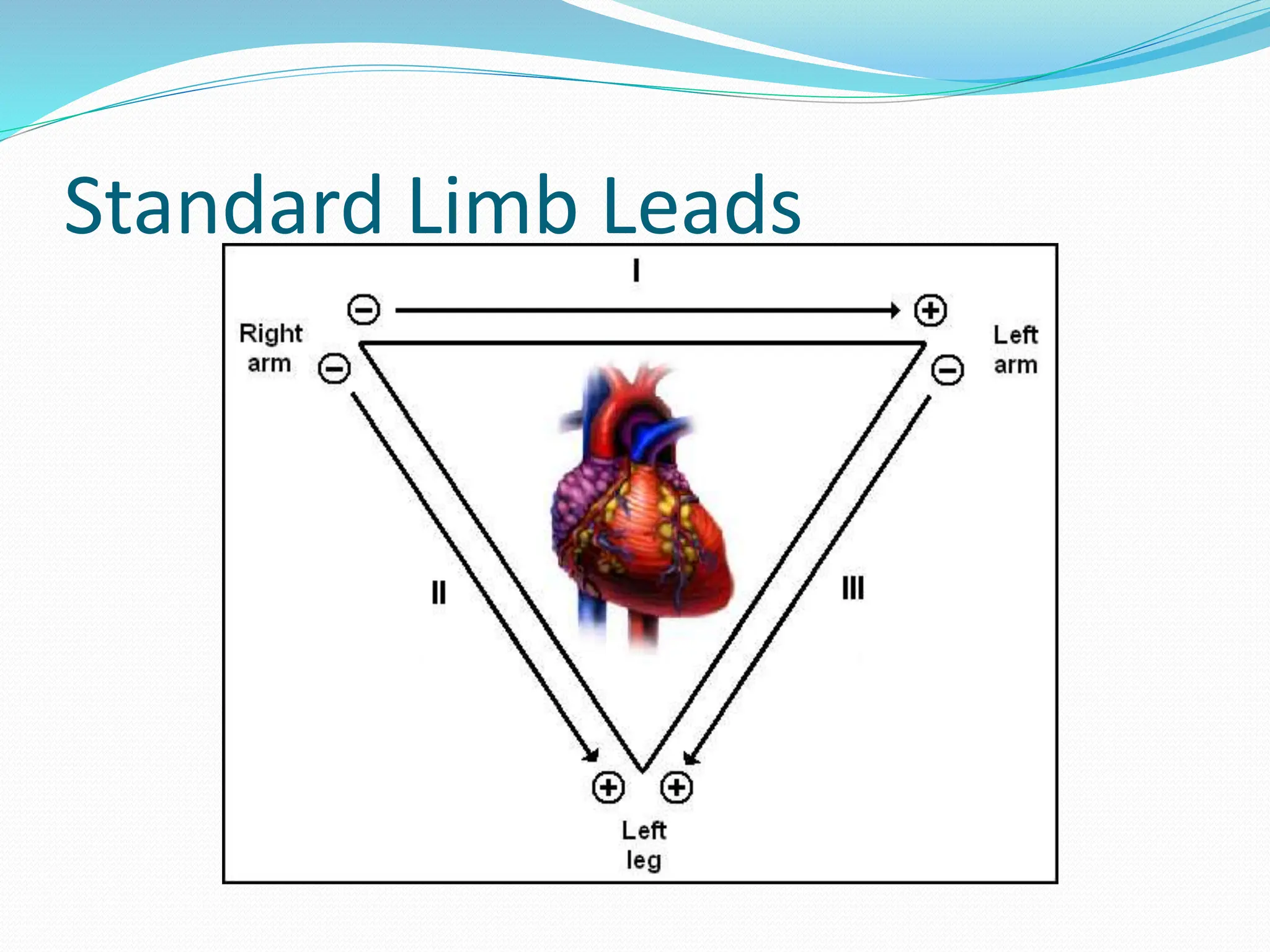 Standard Limb Leads
 