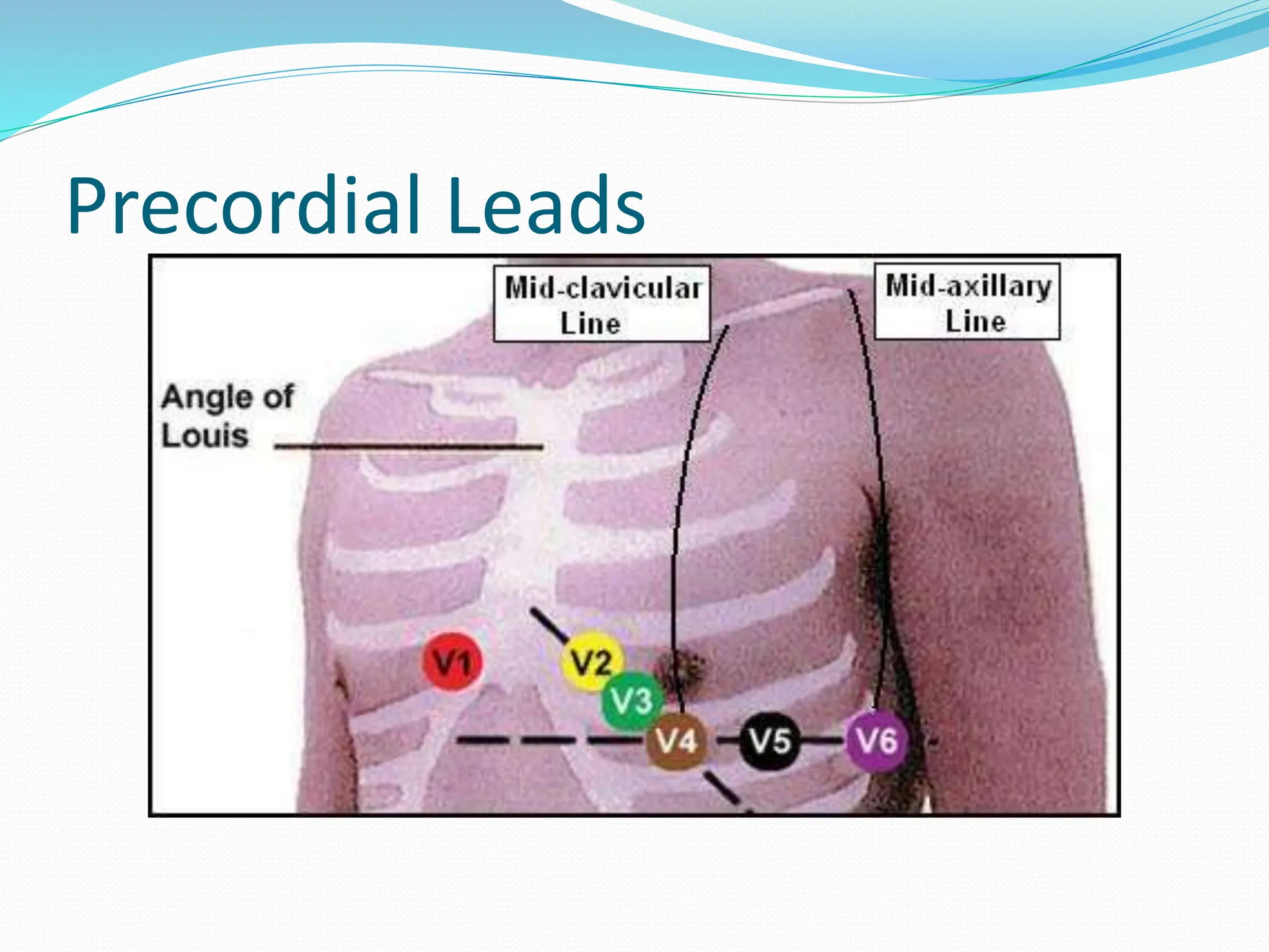Precordial Leads
 