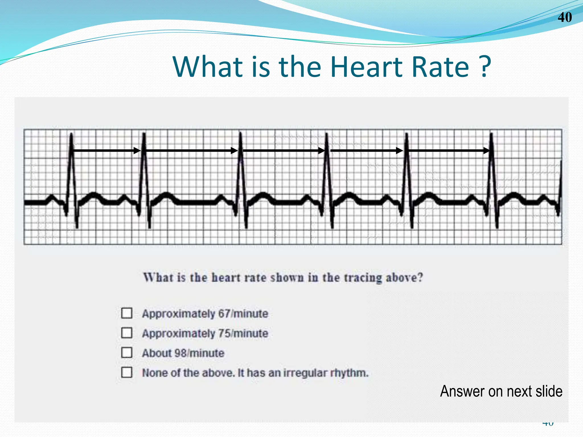 40
40
What is the Heart Rate ?
Answer on next slide
 