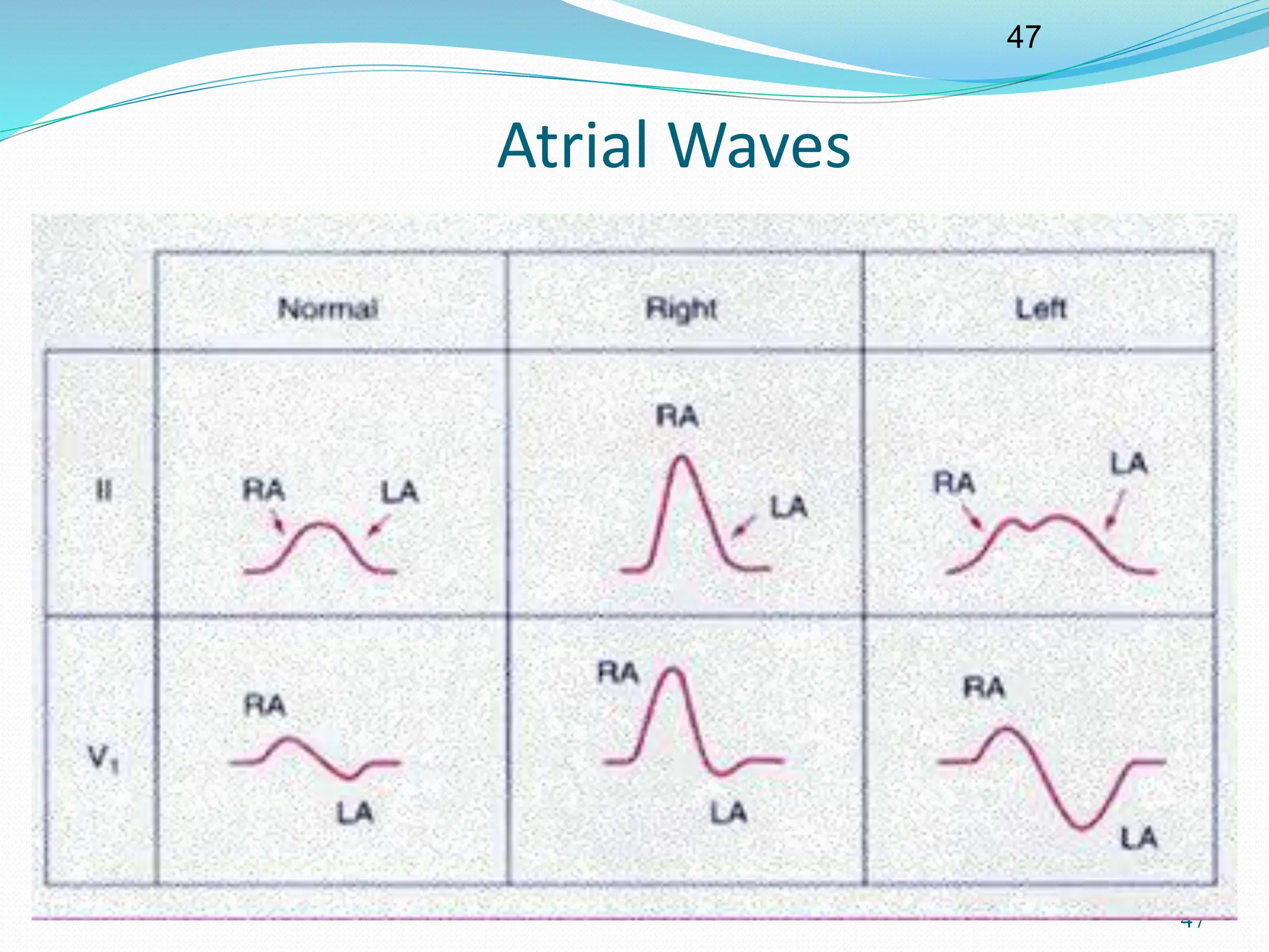 47
47
Atrial Waves
 