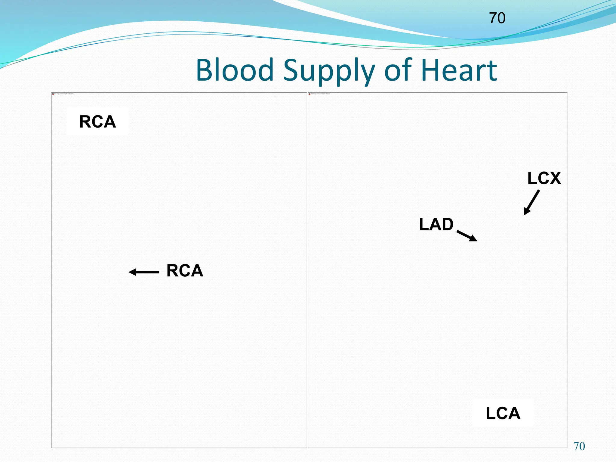 70
70
Blood Supply of Heart
LCA
RCA
LAD
LCX
RCA
 