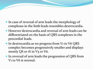  In case of reversal of arm leads the morphology of
complexes in the limb leads resembles dextrocardia.
 However dextrocardia and reversal of arm leads can be
differentiated on the basis of QRS complexes in the
precordial leads.
 In dextrocardia as we progress from V1 to V6 QRS
complex becomes progressively smaller and displays
mostly QS or rS in V5 or V6.
 In reversal of arm leads the progression of QRS from
V1 to V6 is normal.
 